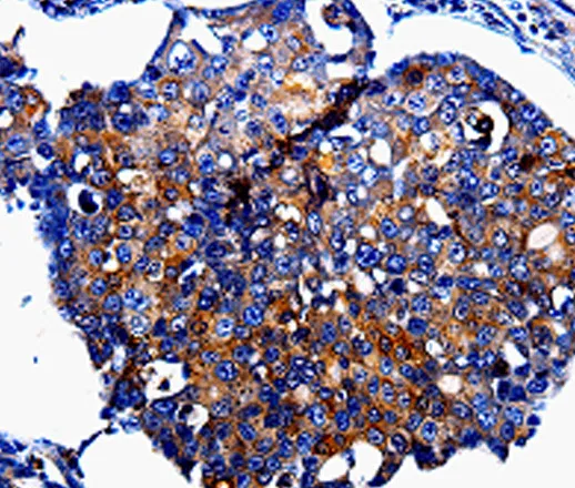 IL10RB Polyclonal Antibody - image 1