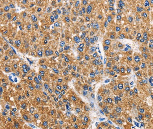 APLNR Polyclonal Antibody - image 1