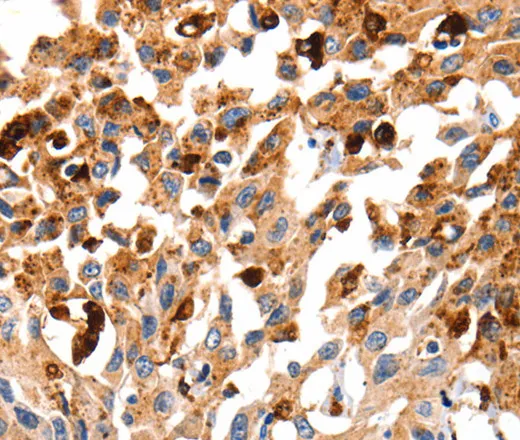 Cathepsin B Polyclonal Antibody - image 1