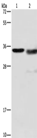 Cathepsin L Polyclonal Antibody - image 1