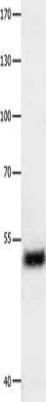 EEF1 gamma Polyclonal Antibody - image 1