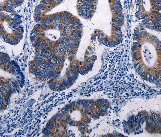 MKP-3 Polyclonal Antibody - image 1