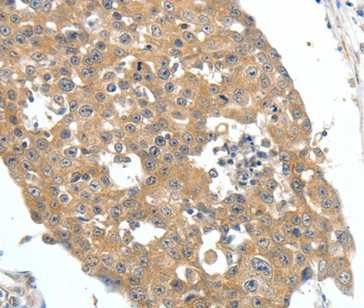 FSHR Polyclonal Antibody - image 1
