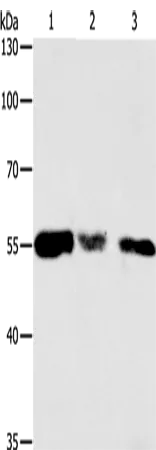 CALR Polyclonal Antibody - image 1