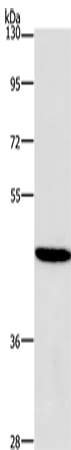 HDAC8 Polyclonal Antibody - image 1