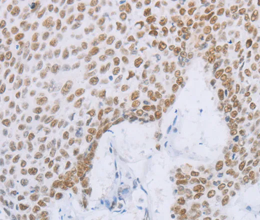 MCM2 Polyclonal Antibody - image 1