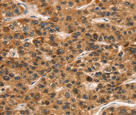 CD159a/c Polyclonal Antibody - image 1