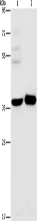 SERPINE2 Polyclonal Antibody - image 1