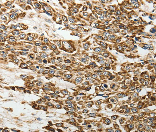 E-Selectin Polyclonal Antibody - image 1