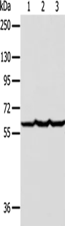Factor IX Polyclonal Antibody - image 1