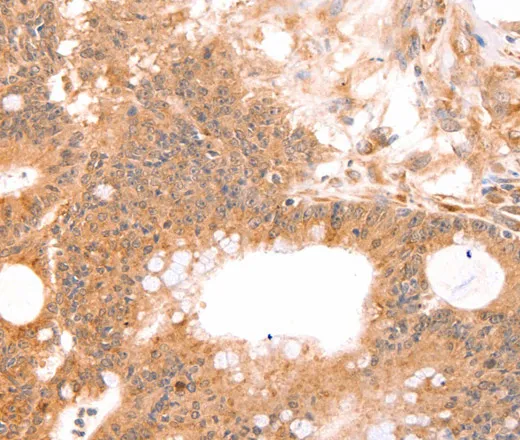 TNF beta Polyclonal Antibody - image 1