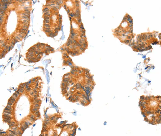 ACOX1 Polyclonal Antibody - image 1