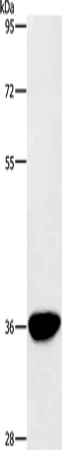 AKR1D1 Polyclonal Antibody - image 1