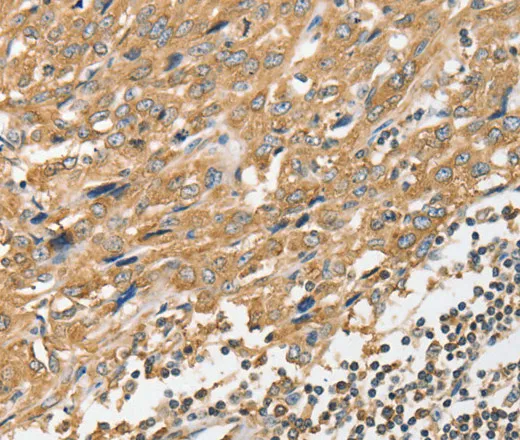 ANGPTL7 Polyclonal Antibody - image 1