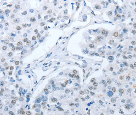 ARHGEF2 Polyclonal Antibody - image 1