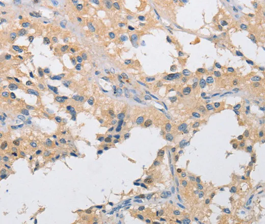 IKK gamma Polyclonal Antibody - image 1