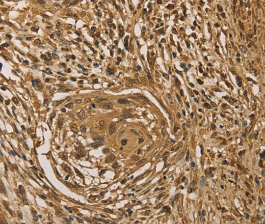 PRDM14 Polyclonal Antibody - image 1