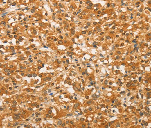 BCL2L14 Polyclonal Antibody - image 1