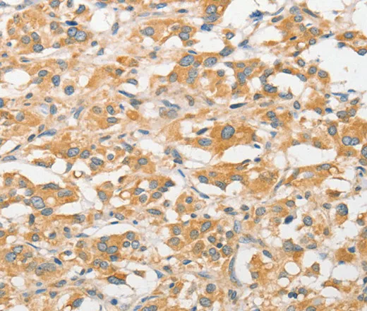 TLR5 Polyclonal Antibody - image 1