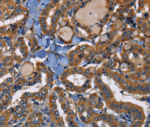 EPHB6 Polyclonal Antibody - image 1