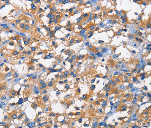 PFKP Polyclonal Antibody - image 1