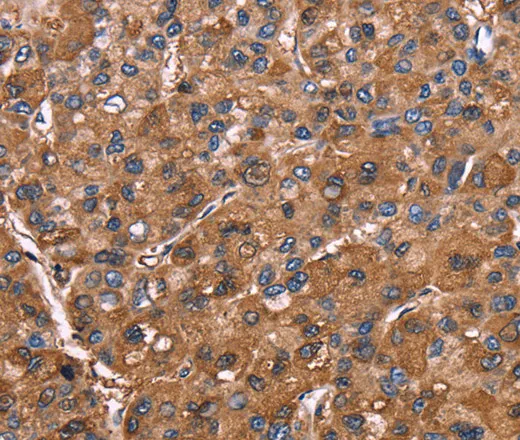 ELP2 Polyclonal Antibody - image 1