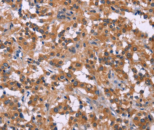 PIP5K1B Polyclonal Antibody - image 1