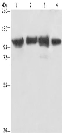 ACTN4 Polyclonal Antibody - image 1