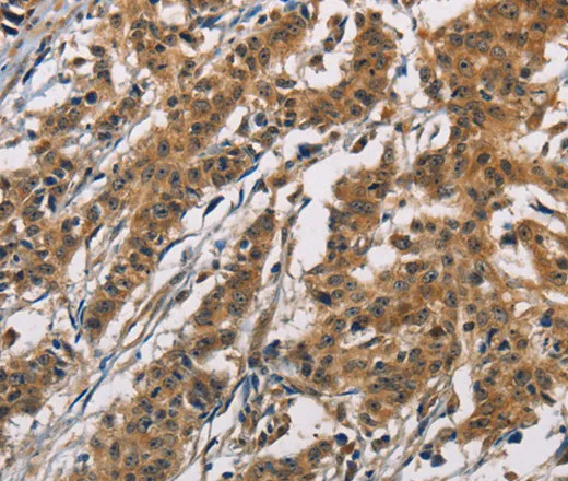 ATP2C1 Polyclonal Antibody - image 1