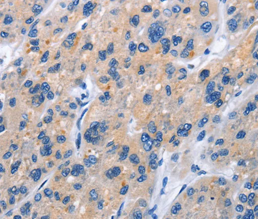 CD137 Polyclonal Antibody - image 1