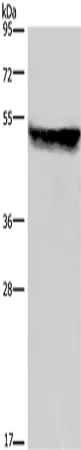 CYP2E1 Polyclonal Antibody - image 1