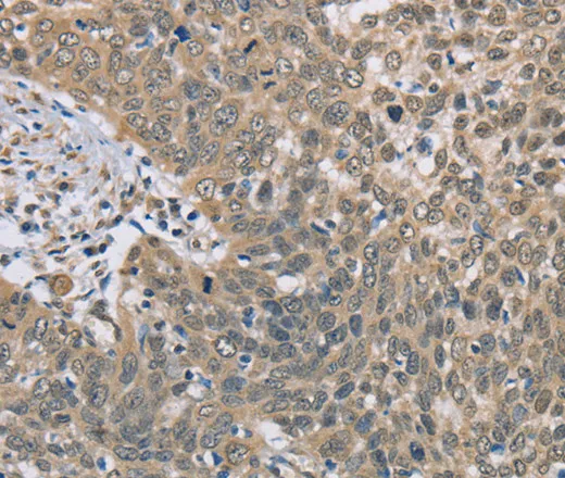 DACH2 Polyclonal Antibody - image 1