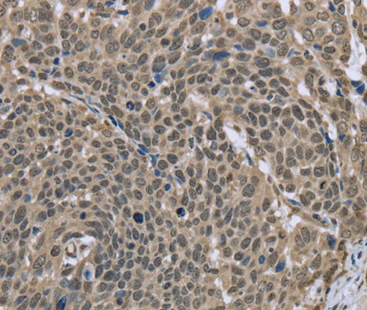 DCTN4 Polyclonal Antibody - image 1