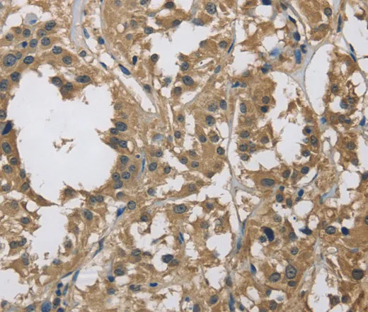 DSG2 Polyclonal Antibody - image 1