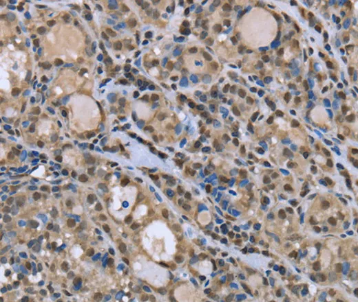 DYNLL1 Polyclonal Antibody - image 1