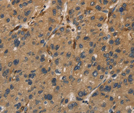 UBE2S Polyclonal Antibody - image 1