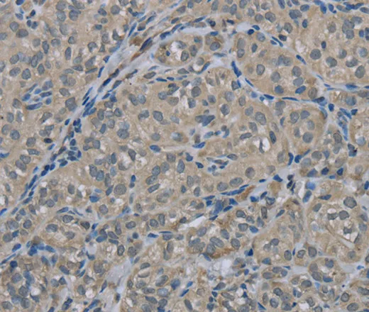 EDN1 Polyclonal Antibody - image 1