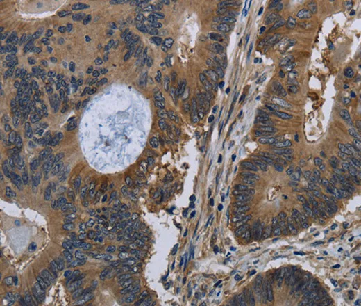 TSC22D3 Polyclonal Antibody - image 1