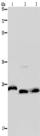 GSTP1 Polyclonal Antibody - image 1