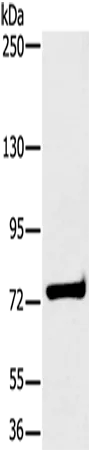 HSD17B4 Polyclonal Antibody - image 1