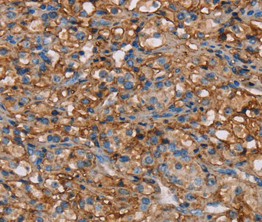 NEDD4L Polyclonal Antibody - image 1