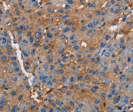 NLGN1 Polyclonal Antibody - image 1