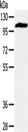 PYGM Polyclonal Antibody - image 1