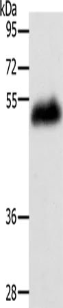 LOX Polyclonal Antibody - image 1