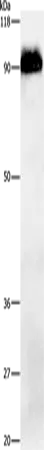 beta Amyloid Polyclonal Antibody - image 1