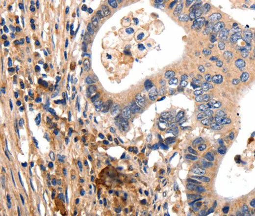 GSK3 alpha Polyclonal Antibody - image 1