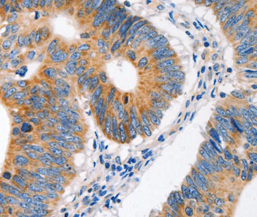 MC1R Polyclonal Antibody - image 1