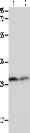 14-3-3 beta/alpha Polyclonal Antibody - image 1