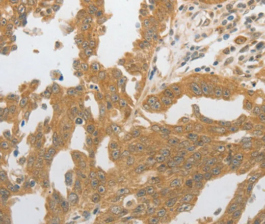 GRIN2C Polyclonal Antibody - image 1