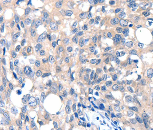 GRIN2D Polyclonal Antibody - image 1